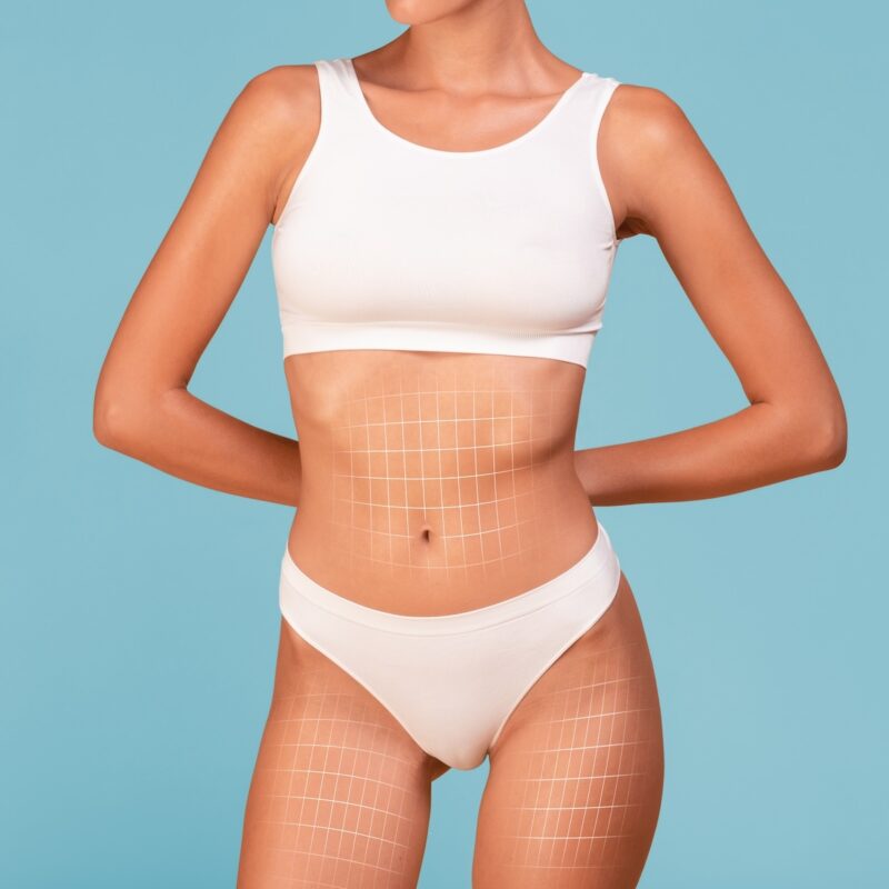 Cropped Shot Of Slim Female Torso With Drawn Lifting Up Mesh On It, Unrecognizable Young Woman With Athletic Figure In White Underwear Standing Isolated On Blue Background, Collage, Copy Space