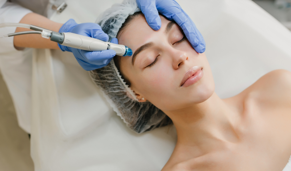 Dermabrasion with diamond tip in valencia medicina estética.png