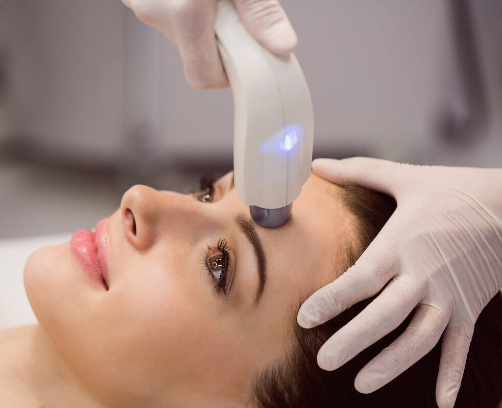 IPL treatment intense pulsed light Valencia aesthetic medicine